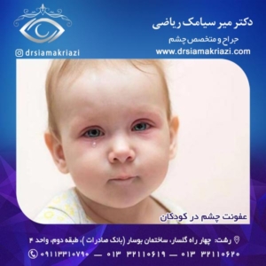 عفونت چشم در کودکان 